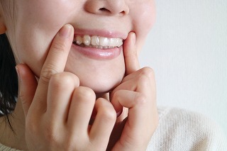 出っ歯は自力で治る？原因と治療法について紹介
