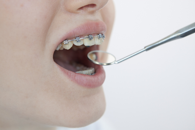 矯正歯科の違いとは？歯列矯正をするなら一般歯科ではなく矯正歯科がおすすめ！