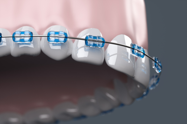 歯列矯正で面長が治る可能性がある歯並びと悪化するケースについて