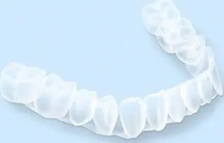 マウスピース型矯正インビザライン