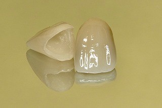 定期的な歯の交換