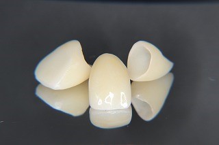 歯が小さくなる