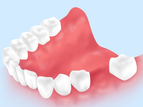 患者様に適した治療をご提案します～歯の機能を取り戻すために～