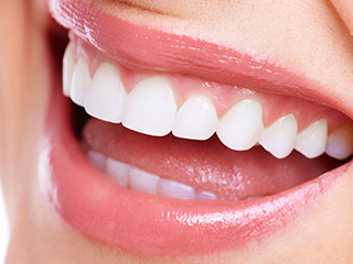 審美治療の知識を深めましょう～メリット・デメリット～