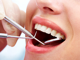 歯科医院でのプロフェッショナルケア