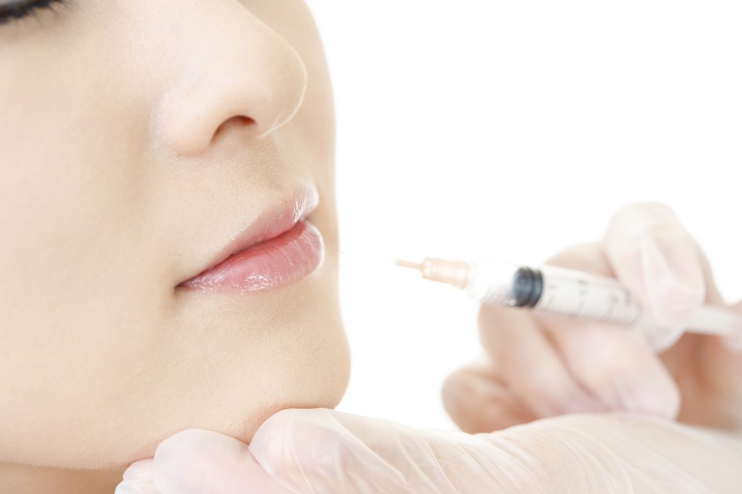 ボトックス治療の様子