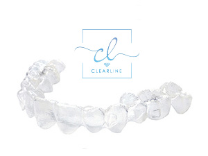 クリアラインマウスピース