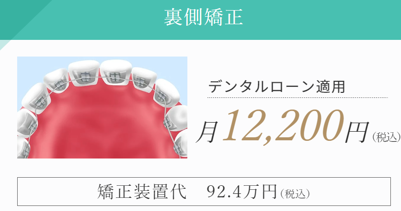 裏側矯正の料金バナー
