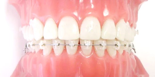 ハーフリンガル