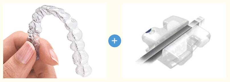 ハイブリッド矯正