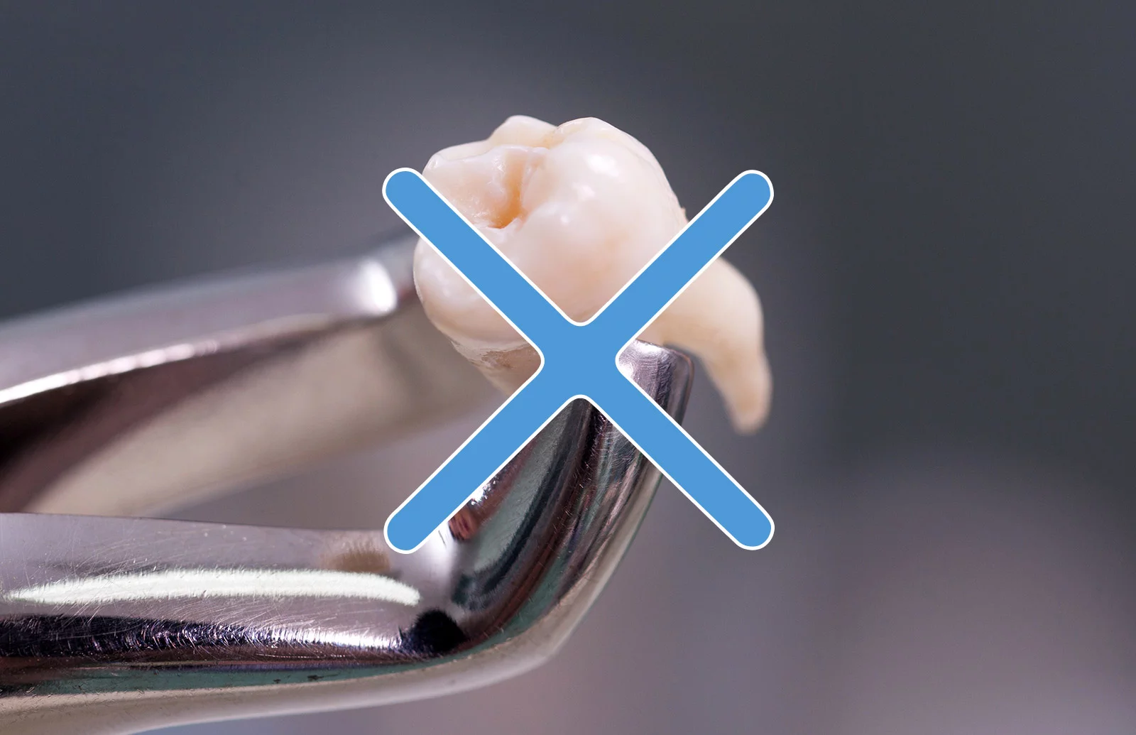 抜歯を回避するイメージ画像