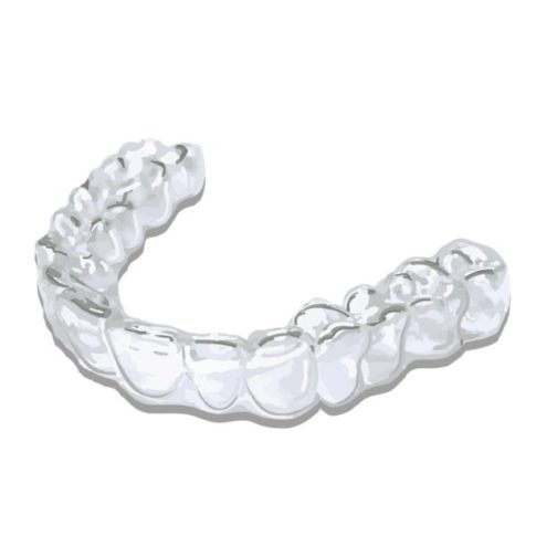 マウスピースの画像