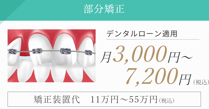 部分矯正の料金バナー