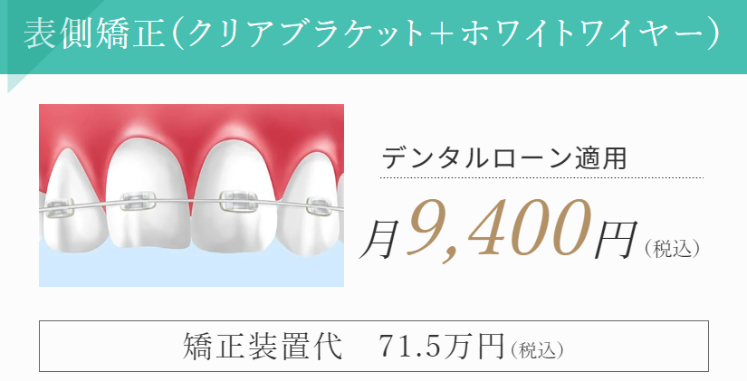 表側矯正(クリアブランケット＋ホワイトワイヤー)の料金バナー