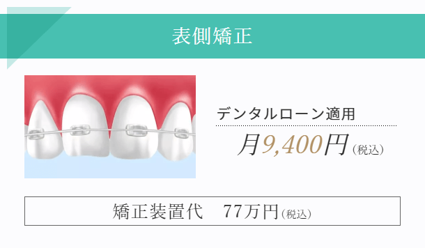 渋谷駅3分の表側（ワイヤー）矯正歯科｜ルーブル歯科・矯正歯科
